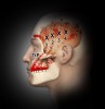 Fig 4. Tempororalis trigger points (TrP) and referred pain.